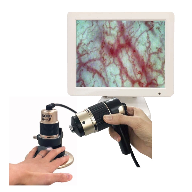 販売終了】毛細血管スコープ モニタータイプ Bscan-Z|顕微鏡・光学機器 